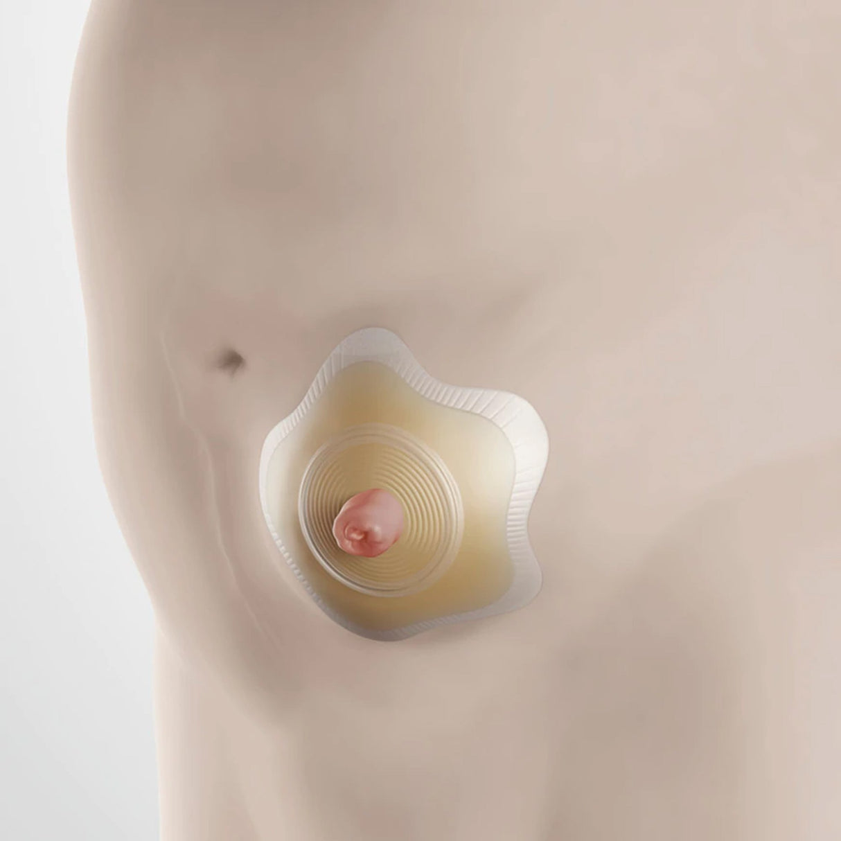 Ostomy Barrier SenSura Mio Convex Flip Precut, Extended Wear Elastic Adhesive 50 mm Flange Red Code System 1-3/16 Inch Opening