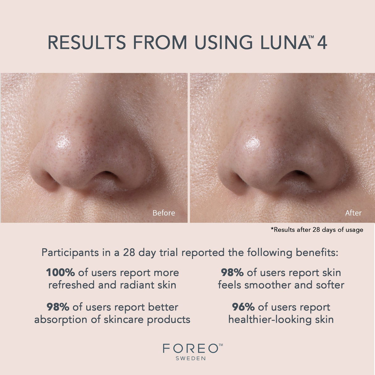 Facial Cleansing Brush and Massage Device LUNA 4 Balanced Skin