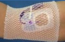 Elastic Net Retainer Dressing ProNet Tubular Gauze 8 Inch Length One Size Fits Most White Arm NonSterile