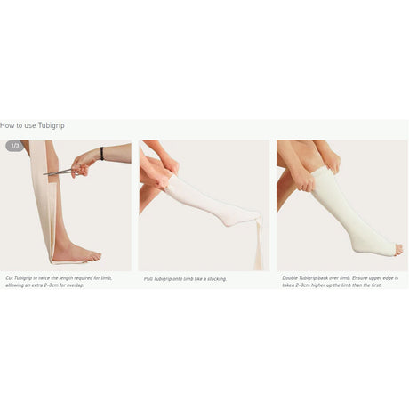 Elastic Tubular Support Bandage Tubigrip 2-3/4 Inch X 11 Yard Medium Arm / Small Ankle Pull On Natural NonSterile Size C Standard Compression