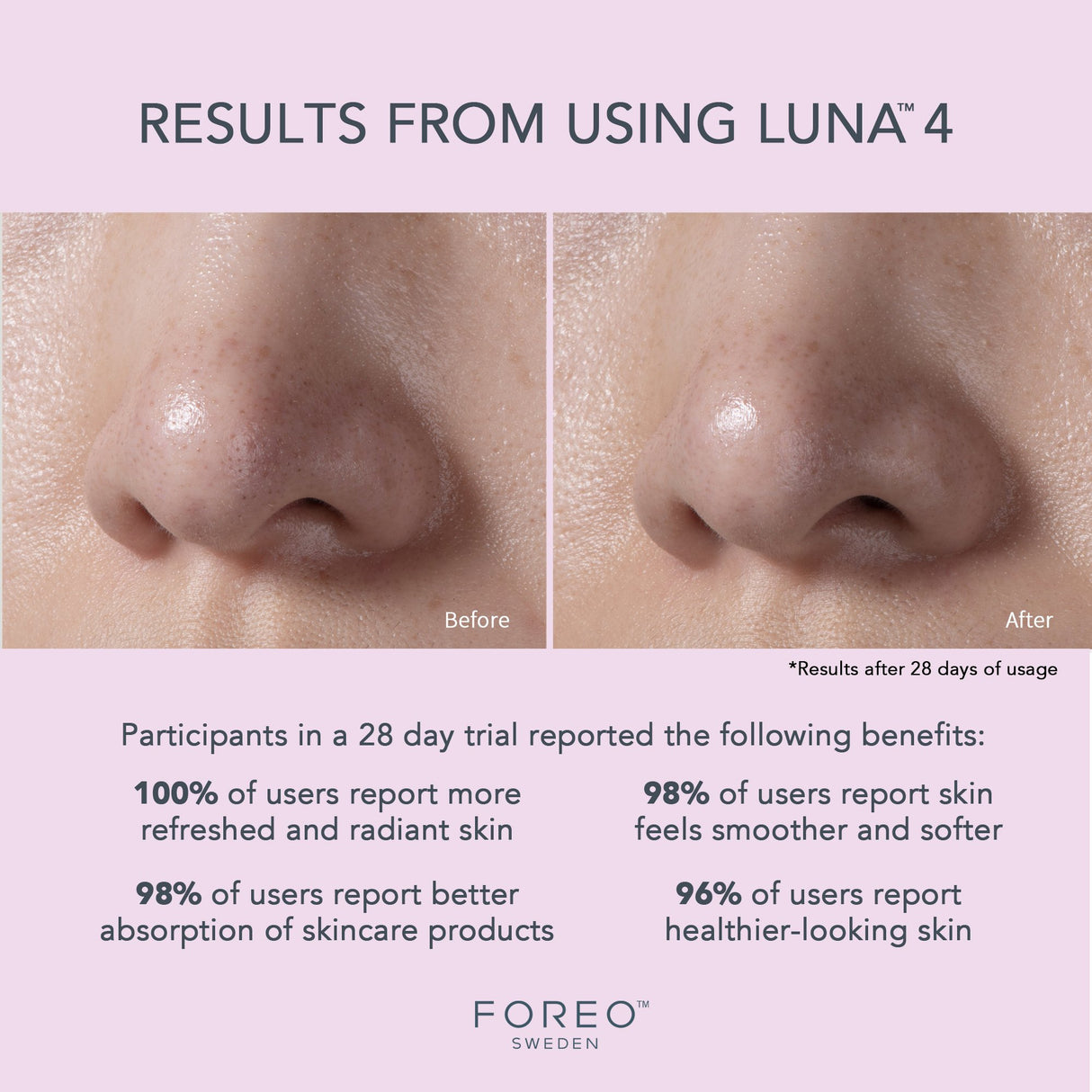 Facial Cleansing Brush and Massage Device LUNA 4 Sensitive Skin