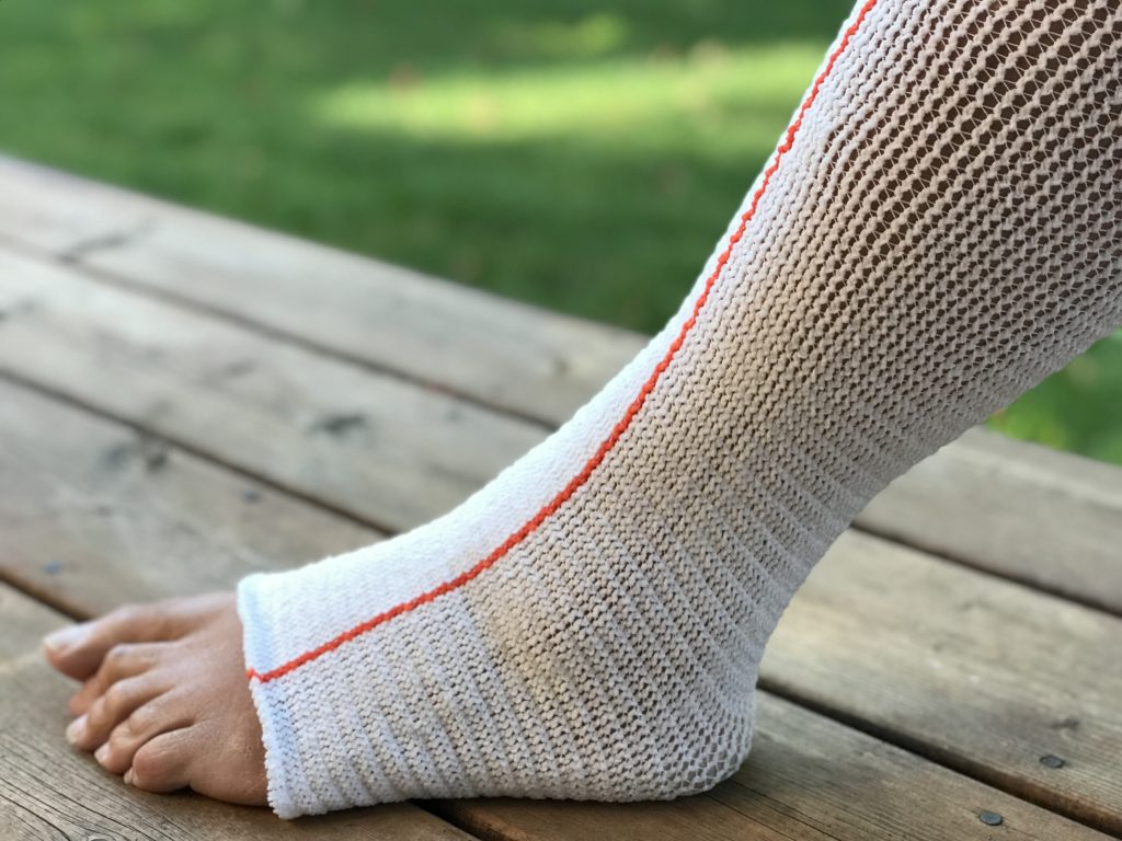 Edemawear Lite Stockinet Medium For Tender Skin For Limb Circumference Up To 90 Cm (36"), Orange Stripe, Single Stockinet  - 1 Each