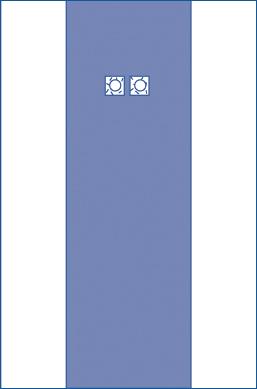 Sterile Femoral Angiography Surgical Drapes