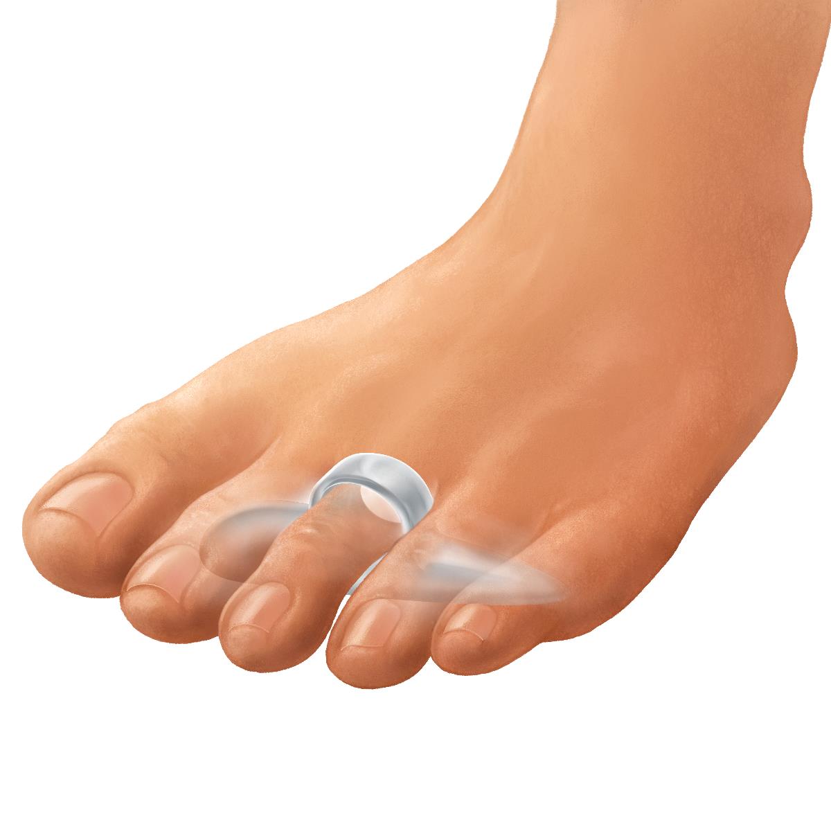 Gel Hammer Toe Crest