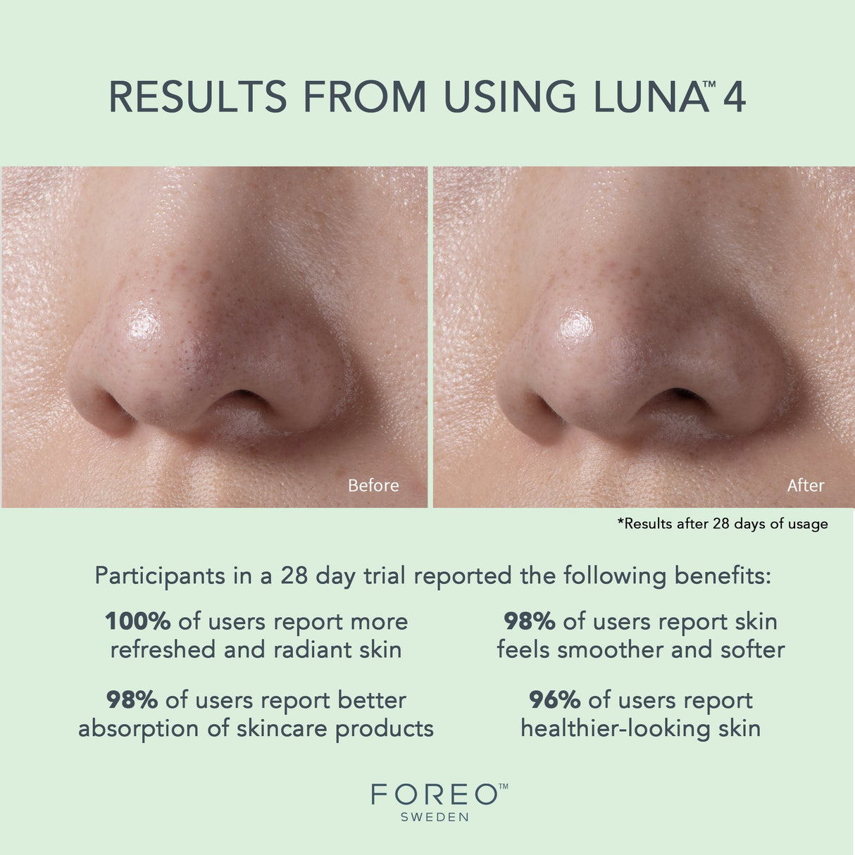 Facial Cleansing Brush and Massage Device LUNA 4 Combination Skin